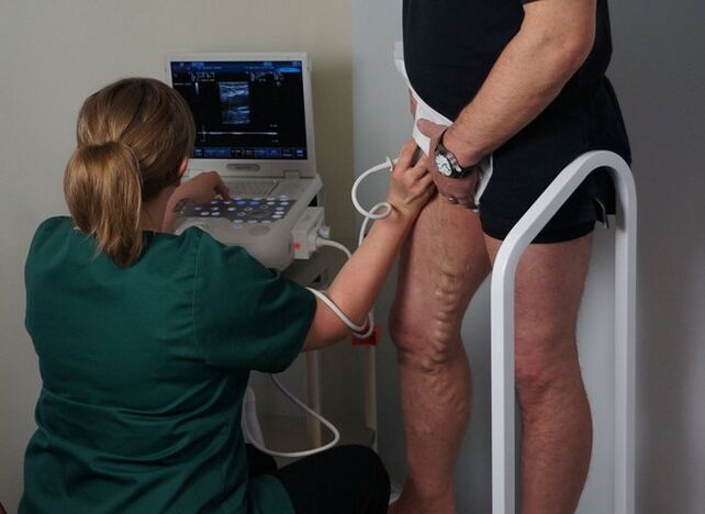 examinarea venelor înainte de coagularea cu laser pentru vene varicoase